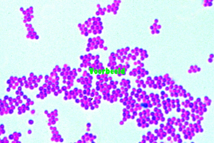 S aureus рисунок